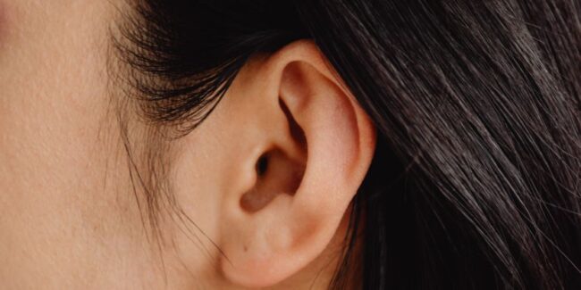 Cómo afecta la pericondritis a tu oreja